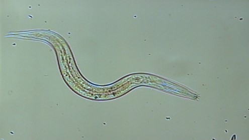 Microscopic transparent, S-shaped worm-like organism 