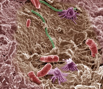 Colorized microscope image showing red rod-shaped bacteria and purple spiky structures  on textured tissue surface.