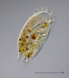 Microscopic single-celled ovular organism with a transparent body containing gold-brown spots and hair-like cilia projections around its edge